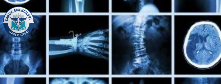 radyoloji-skandali-iddiasi-savcilik-harekete-gecti-yanlis-raporlar-mercek-altinda-saglik-emekcileri-haber-kanali-8OcqeH6G.png